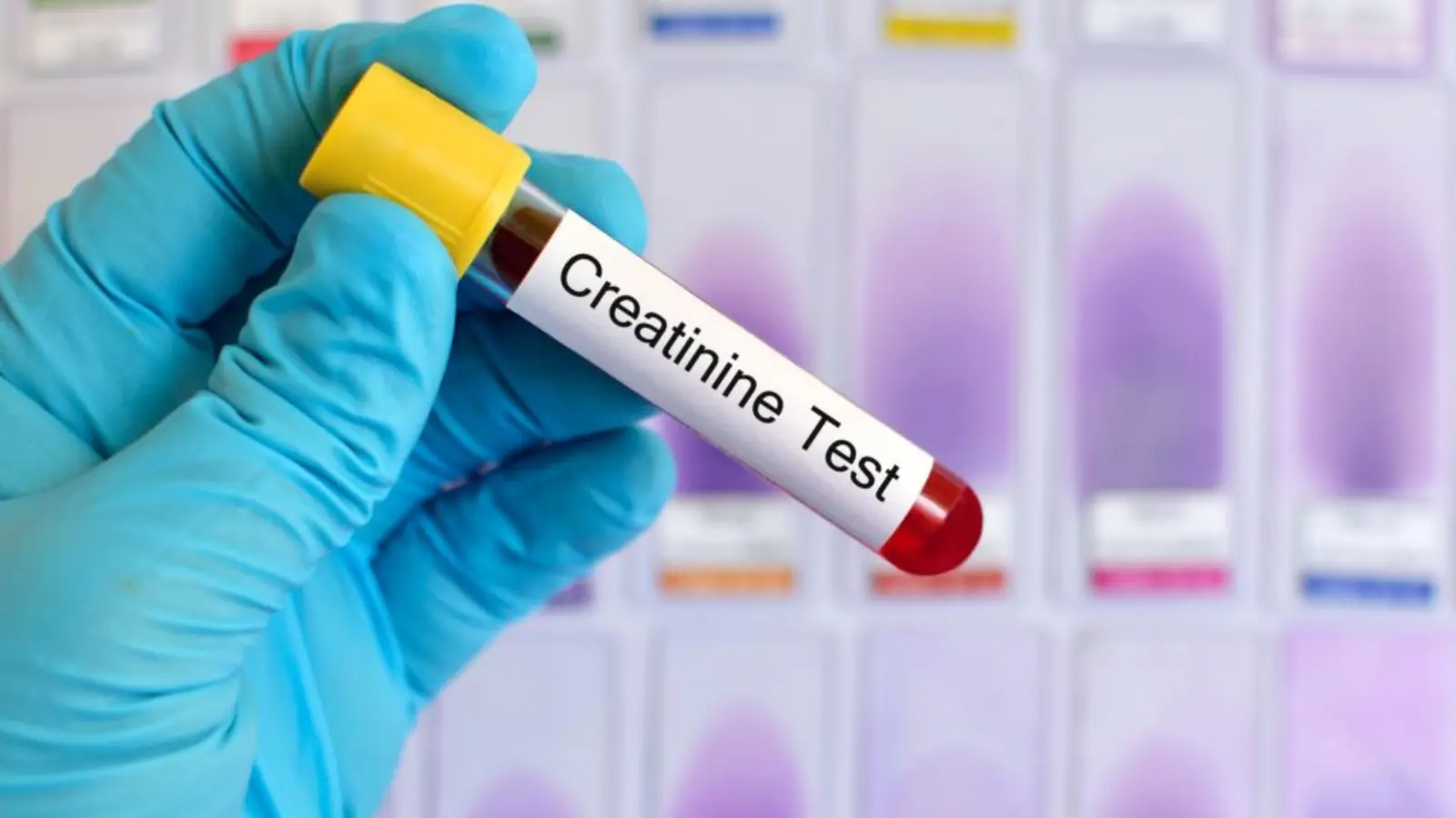 what does low creatinine mean