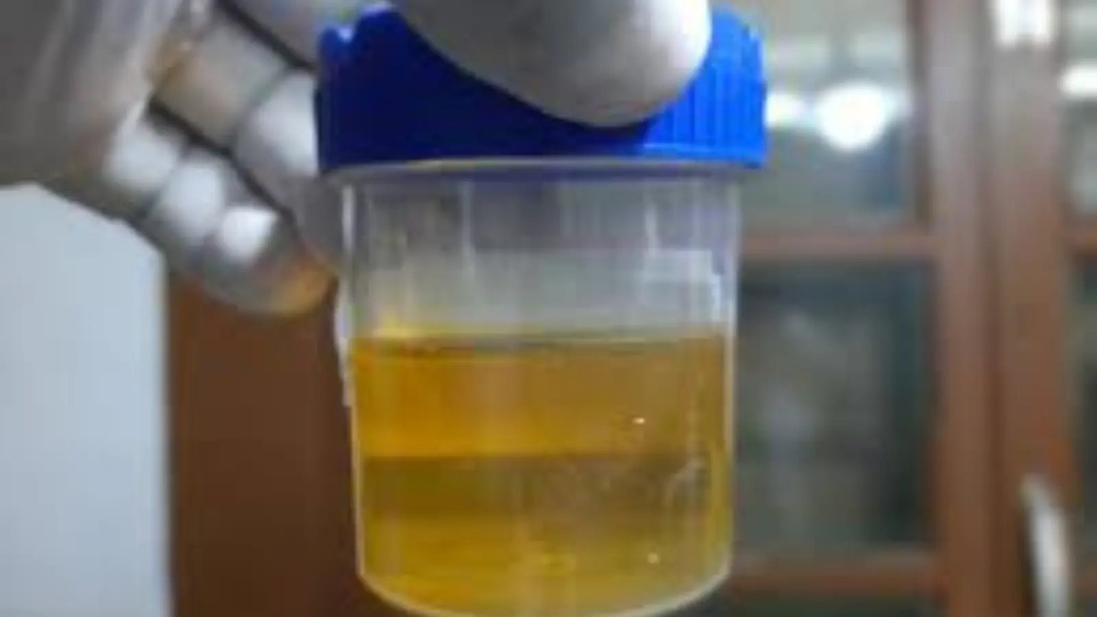 what does protein in urine mean